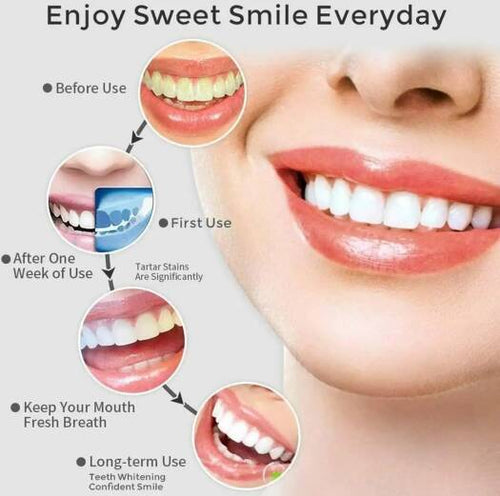 Portable Pro Dental Flosser