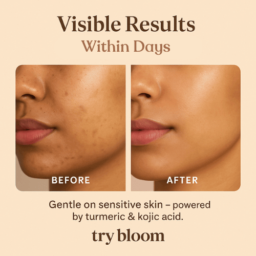 Kojic Face Wash